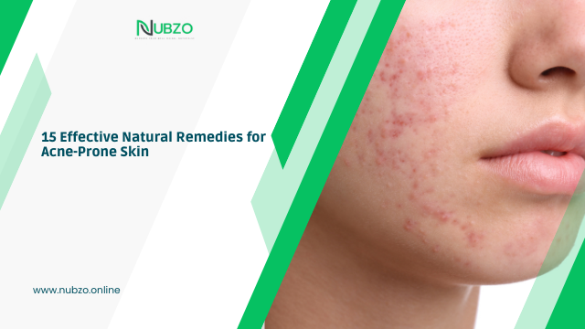 15 Effective Natural Remedies for Acne-Prone Skin